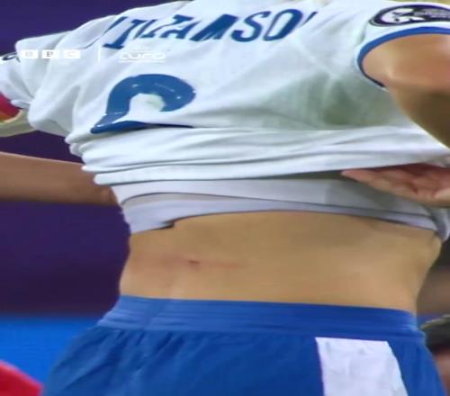妹紙身上被鏟出血洞！BBC：這難道不是紅牌嗎
