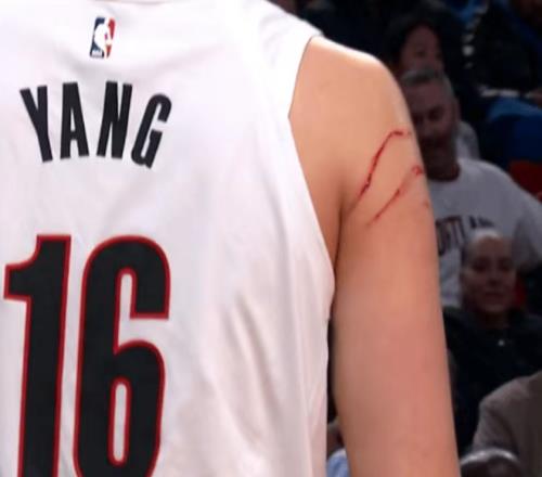 創(chuàng)NBA生涯紀(jì)錄！楊瀚森連7戰(zhàn)登場(chǎng)入輪轉(zhuǎn)被抓出兩道血痕引爭(zhēng)議