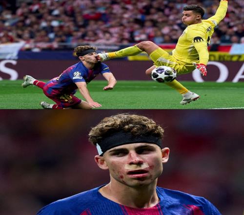 慎入,費爾明被穆索用鞋釘蹬中麵部,鮮血直流