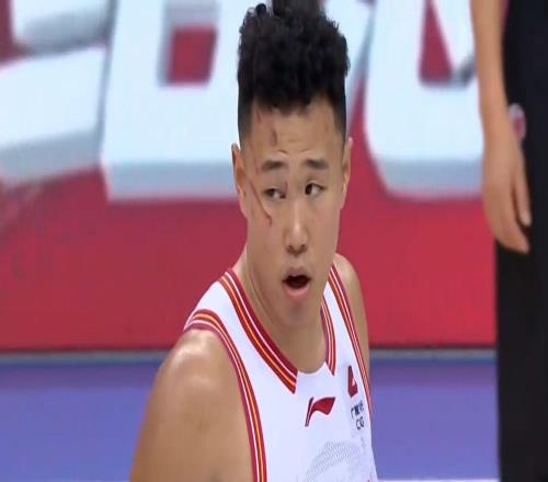 CBA强度这么大国手后卫遭九阴白骨爪袭击,面部血痕累累不犯规