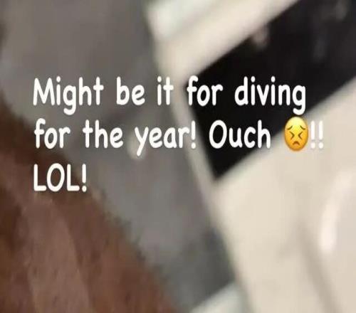 渗人!詹姆斯晒血肉伤口!真的太拼了.....