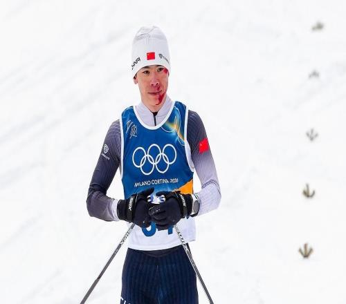 面部大面积擦伤！终点线，全场观众向赵子贺致意