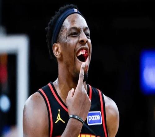 被打掉兩顆牙！老鷹官宣奧孔古成功手術缺席對陣火箭步行者兩場