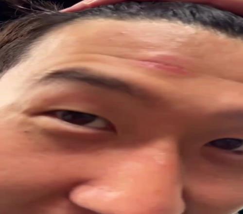 脑门肿了！孙兴慜被人推撞到了奖杯，但孙哥高兴得合不拢嘴