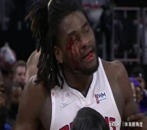 爆，无限期禁赛，血溅三尺+替补席爆燃，果真是血抗老詹的人