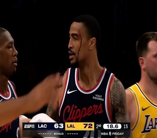 80+15+24！湖人三巨头爆发，伦纳德31分&伤退，新援轰26分难救主