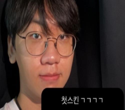 Doran更新动态：皮肤选择安蓓萨酒桶卡蜜尔其他