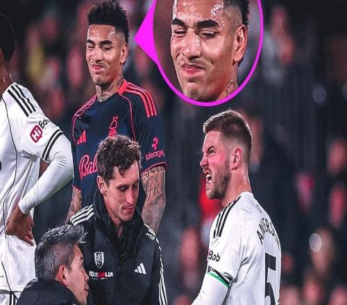 富勒姆后卫安诺生比赛中手指脱臼，队医给他复位时他都不敢看