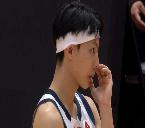 深夜22点，徐杰伤情出炉，骨头和韧带都没事，杜锋这下更揪心了