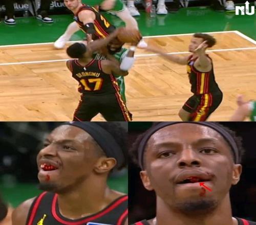 一肘打掉奥孔古牙齿，杰伦布朗：我绝对不是故意的